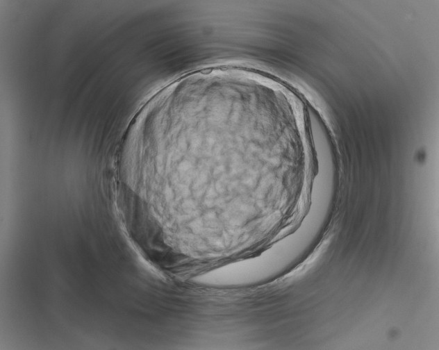 X0000116281001201001111031