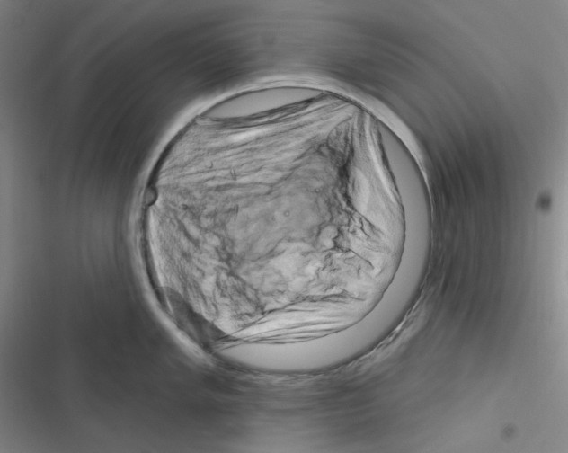 X0000116281005201001111031