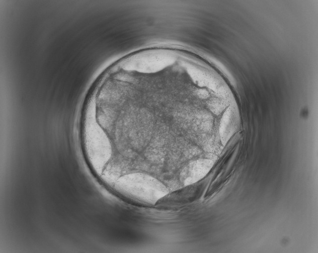 X0000116281007201001111031