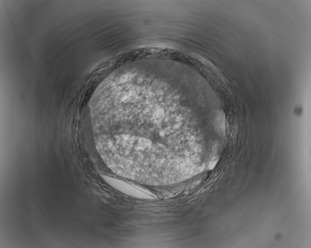 X0000116281014201001111031