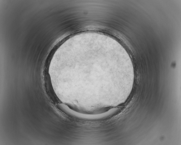 X0000116281026201001111031