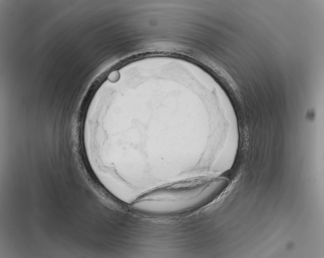 X0000116281029201001111031