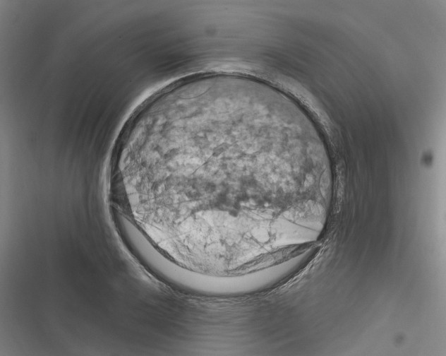 X0000116281032201001111031