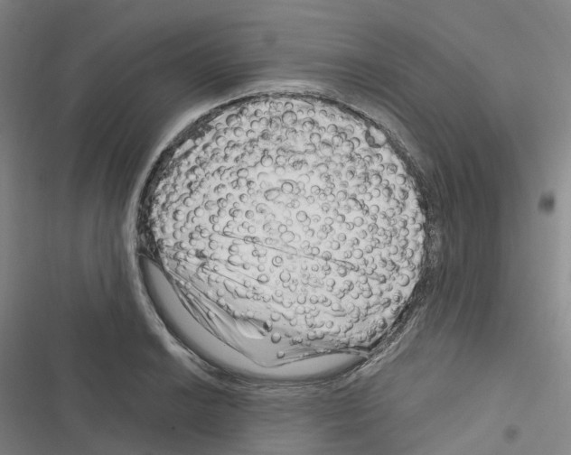 X0000116281038201001111031