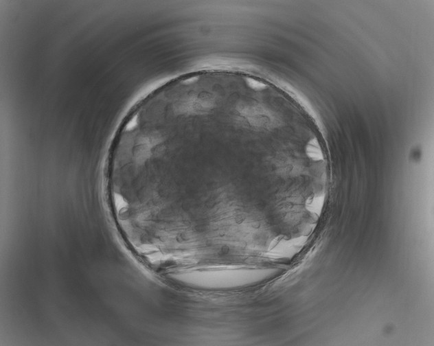 X0000116281045201001111031