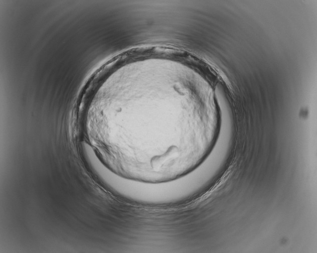 X0000116281069201001111030
