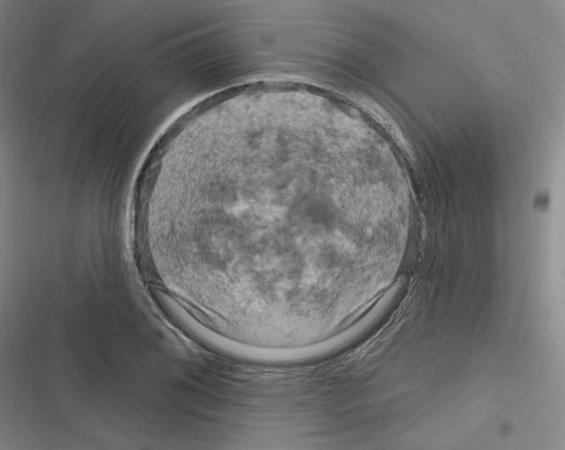 X0000116281076201001111030