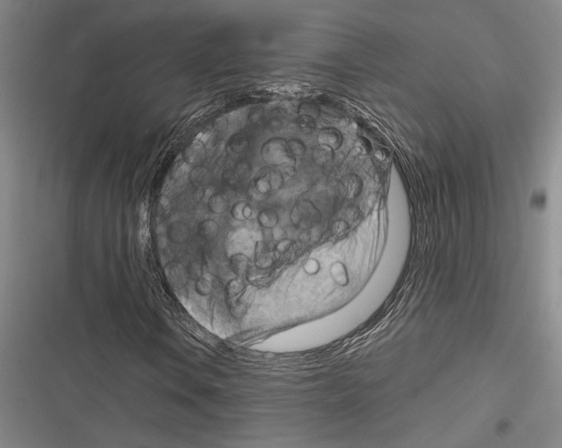 X0000116281106201001111029