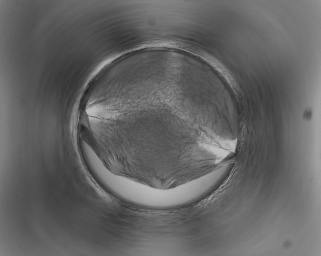 X0000116281127201001111030