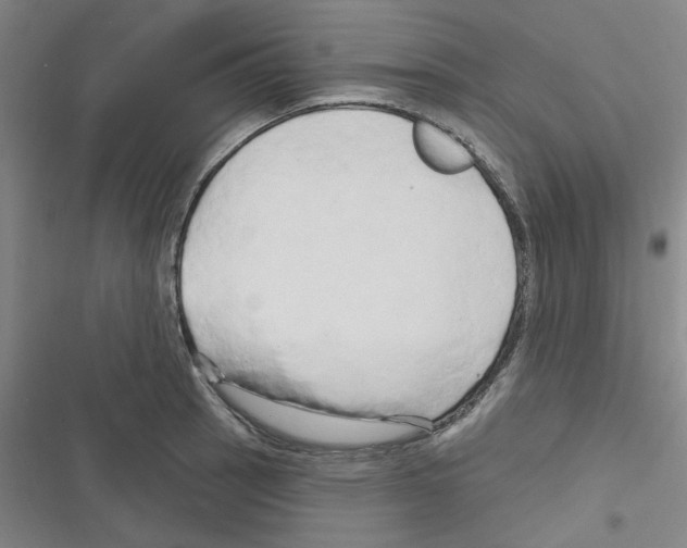 X0000116281137201001111030