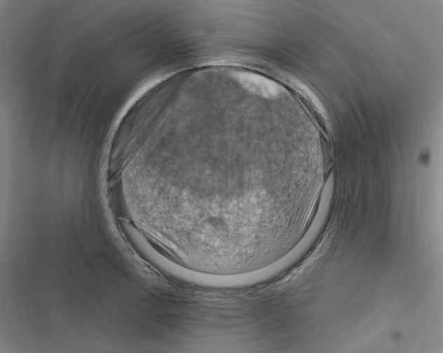 X0000116281138201001111030