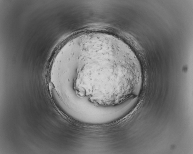 X0000116281164201001111029