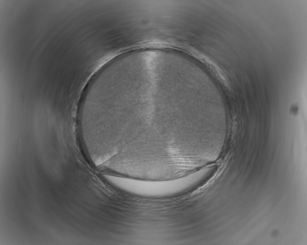 X0000116281170201001111029