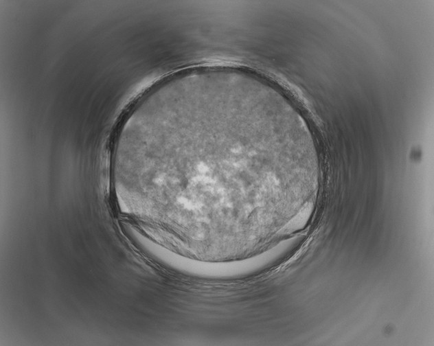 X0000116281171201001111029