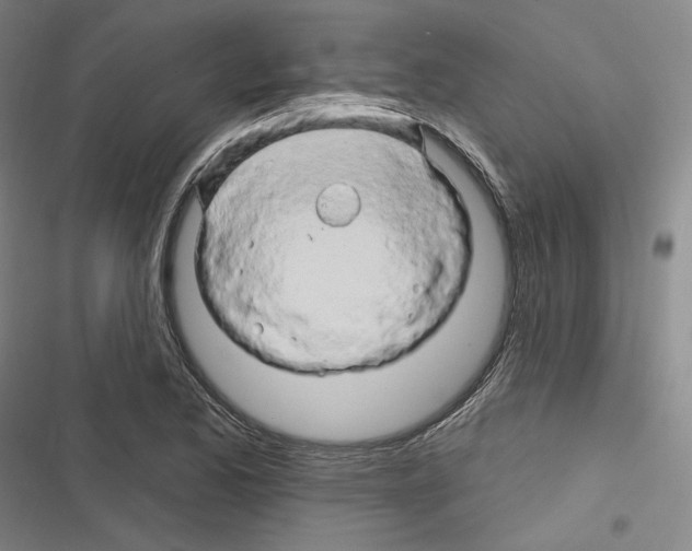 X0000116281173201001111029