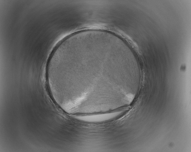 X0000116281174201001111029