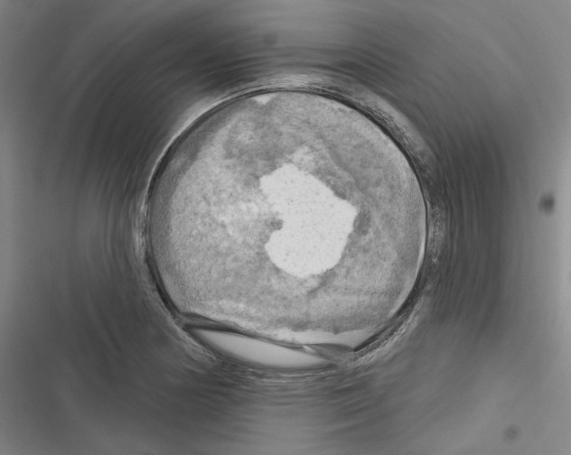 X0000116281178201001111029