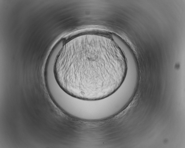 X0000116281181201001111029