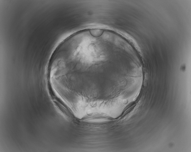 X0000116281231201001111028