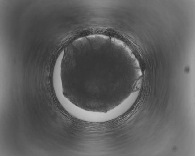 X0000116281252201001111028