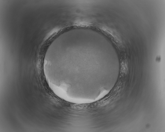 X0000116281254201001111028