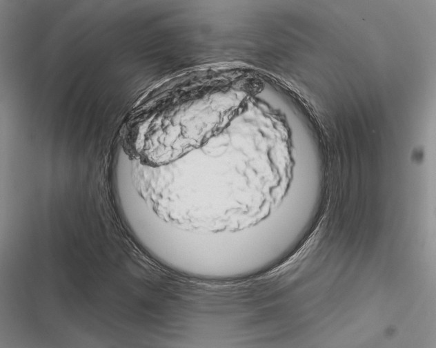 X0000116281257201001111028