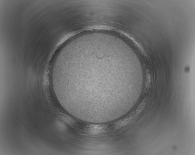 X0000116281266201001111028