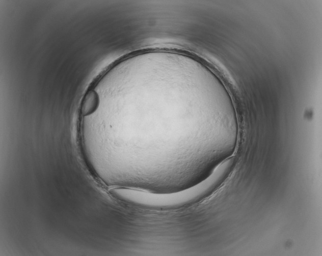 X0000116281277201001111028