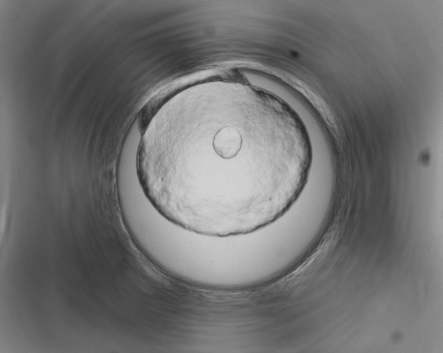X0000116281281201001111027