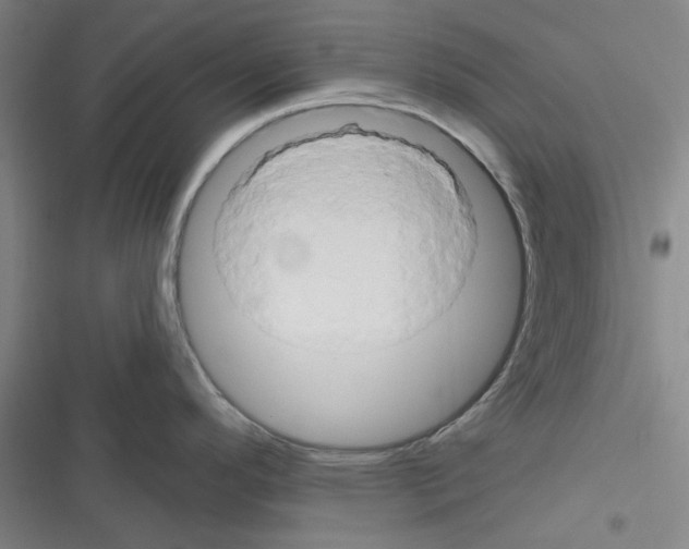 X0000116281296201001111027