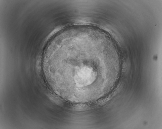 X0000116281314201001111027