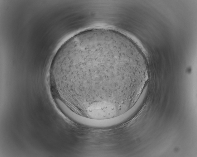 X0000116281335201001111027