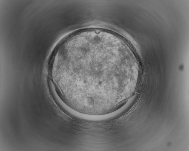 X0000116281368201001111026