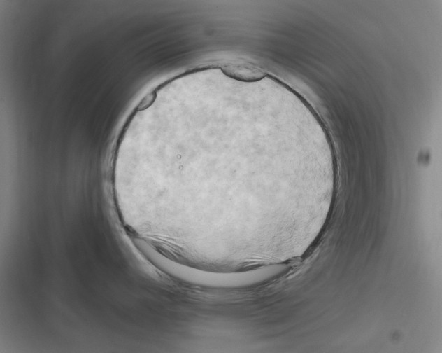 X0000116281392201001111026