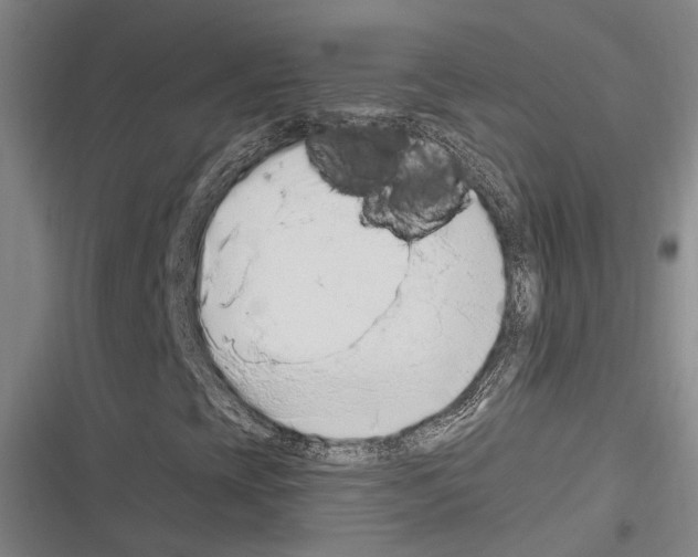 X0000116281393201001111025