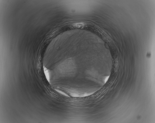 X0000116281394201001111025