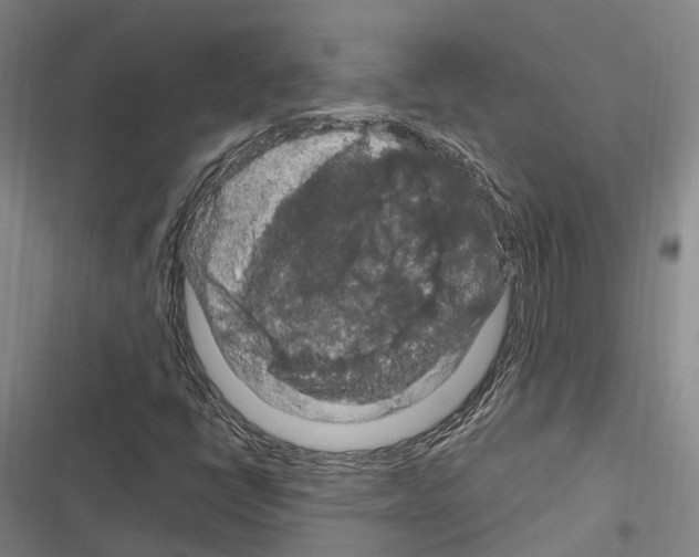 X0000116281398201001111025