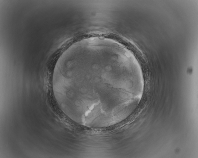 X0000116281399201001111025