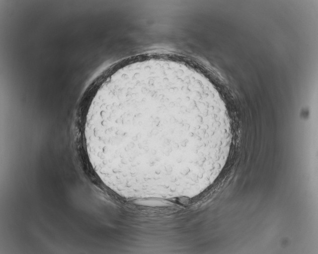 X0000116281400201001111025