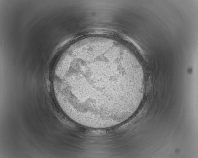 X0000116281403201001111025