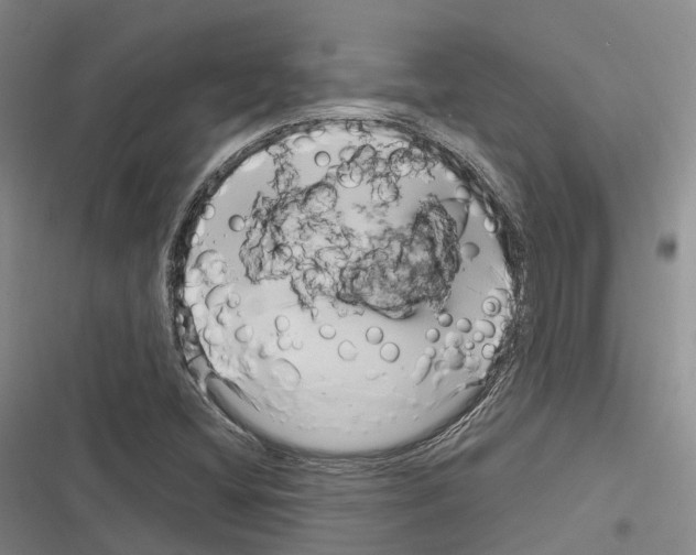 X0000116281404201001111025