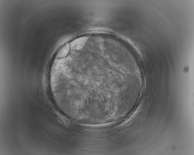 X0000116281405201001111025