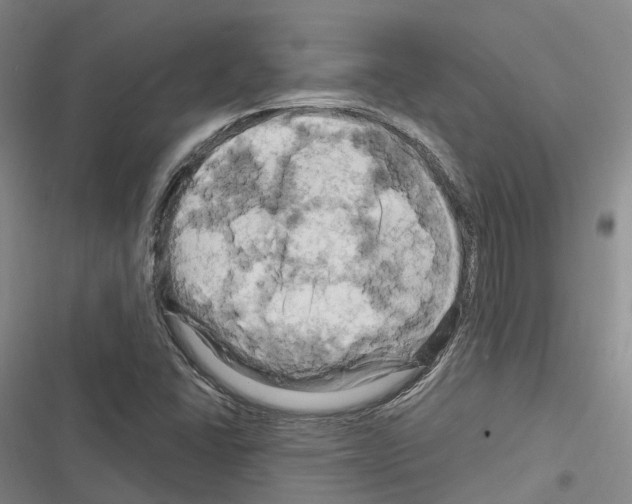 X0000116281406201001111026