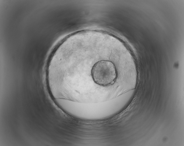 X0000116281416201001111026