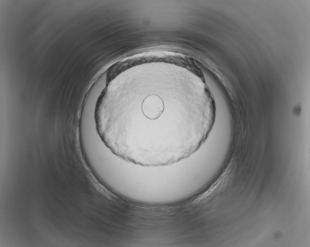 X0000116281417201001111026
