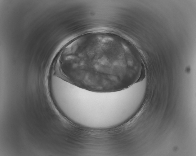 X0000116281418201001111026