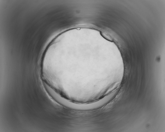 X0000116281430201001111026