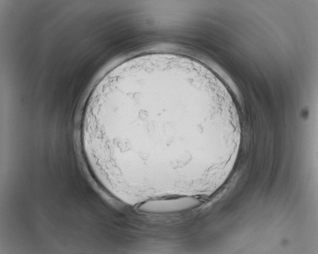 X0000116281437201001111026