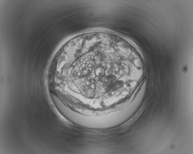 X0000116281438201001111026