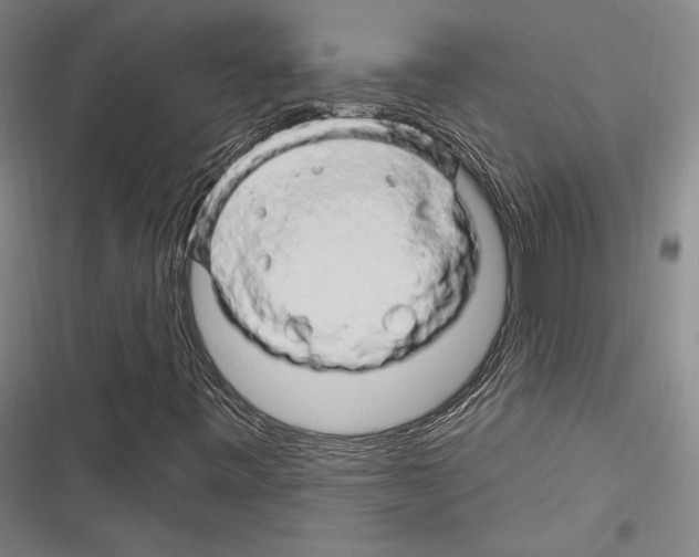 X0000116281443201001111025